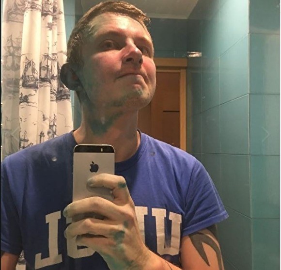 На основателя Conflict Intelligence Team напал неизвестный с зеленкой На основателя Conflict Intelligence Team напал неизвестный с зеленкой