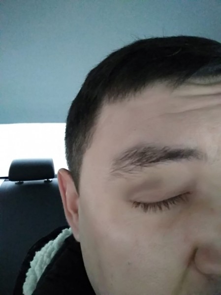 «Бил по голове и забрал тысячу рублей», – пассажир рассказал, как на него напал водитель «Яндекс.Такси» (ФОТО, ВИДЕО)