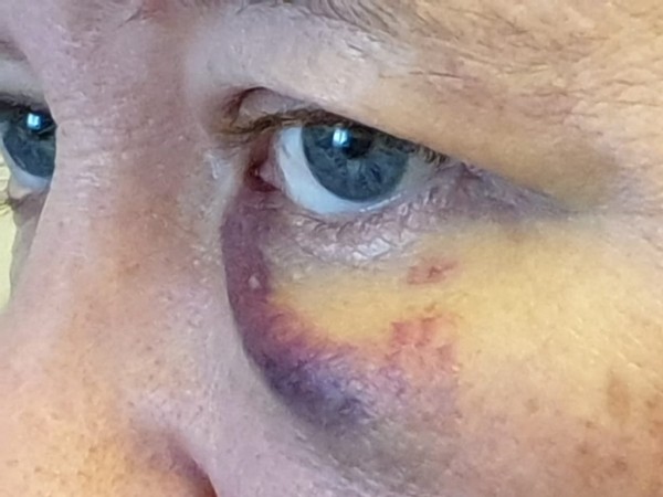 «Бил по голове и забрал тысячу рублей», – пассажир рассказал, как на него напал водитель «Яндекс.Такси» (ФОТО, ВИДЕО) «Бил по голове и забрал тысячу рублей», – пассажир рассказал, как на него напал водитель «Яндекс.Такси» (ФОТО, ВИДЕО)