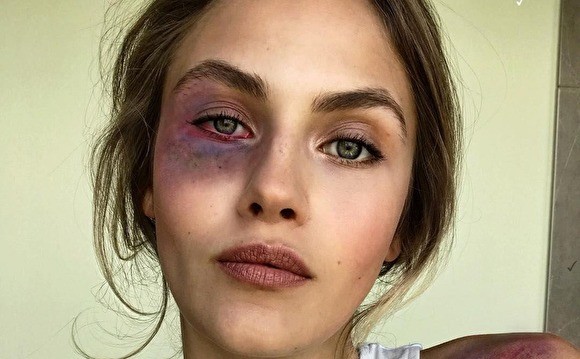 Кризисный центр «Анна» выпустил доклад о насилии по отношению к женщинам в России Кризисный центр «Анна» выпустил доклад о насилии по отношению к женщинам в России