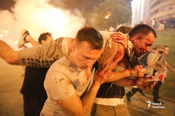 СМИ опубликовали снимки белоруссов, которые пострадали при столкновении с силовиками СМИ опубликовали снимки белоруссов, которые пострадали при столкновении с силовиками