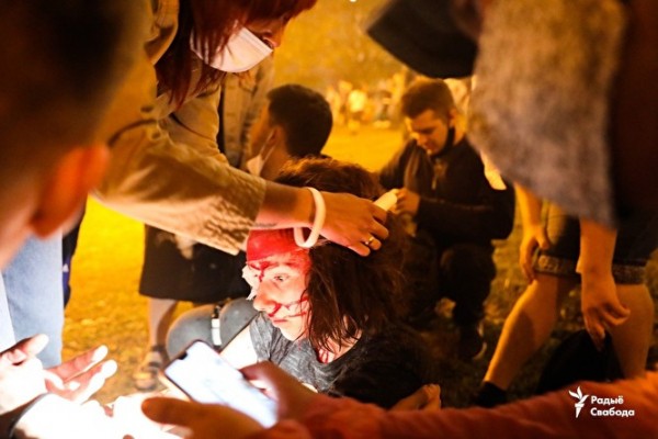 СМИ опубликовали снимки белоруссов, которые пострадали при столкновении с силовиками СМИ опубликовали снимки белоруссов, которые пострадали при столкновении с силовиками