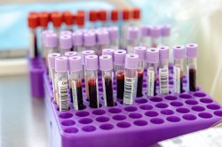 Сотрудники Администрации города Екатеринбурга сдали 19 литров крови